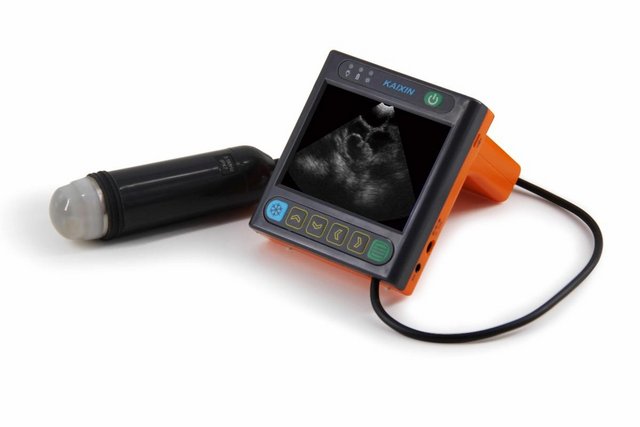 Preview of the first image of MSU 3.0 Pregnancy Scanner.